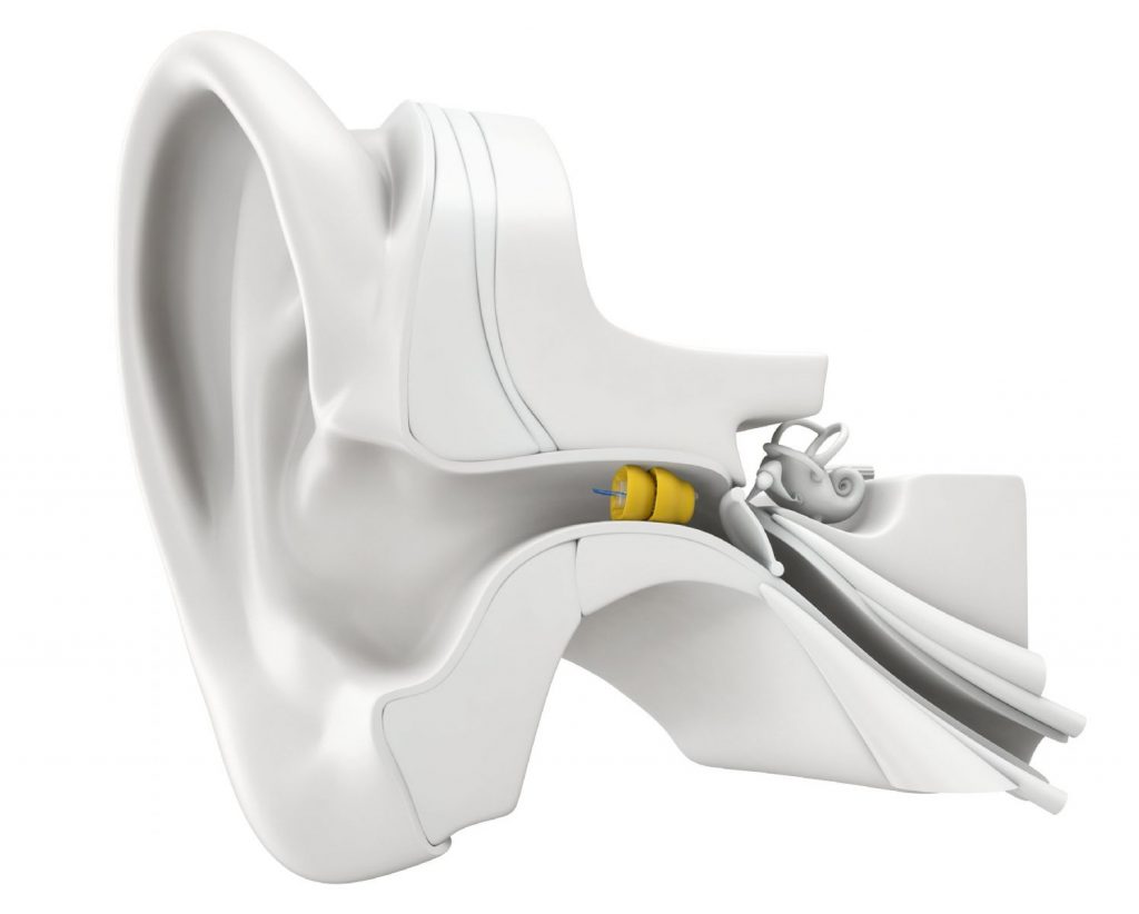 Introducing Lyric – the new 100% invisible extended wear hearing aid